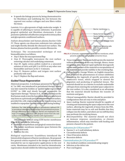 Textbook of Periodontics, 3/E for BDS Final Year and MDS Students | 1300+ Colored Images with GTR, Implant Surgery, Viva-Voce and University Questions: 1