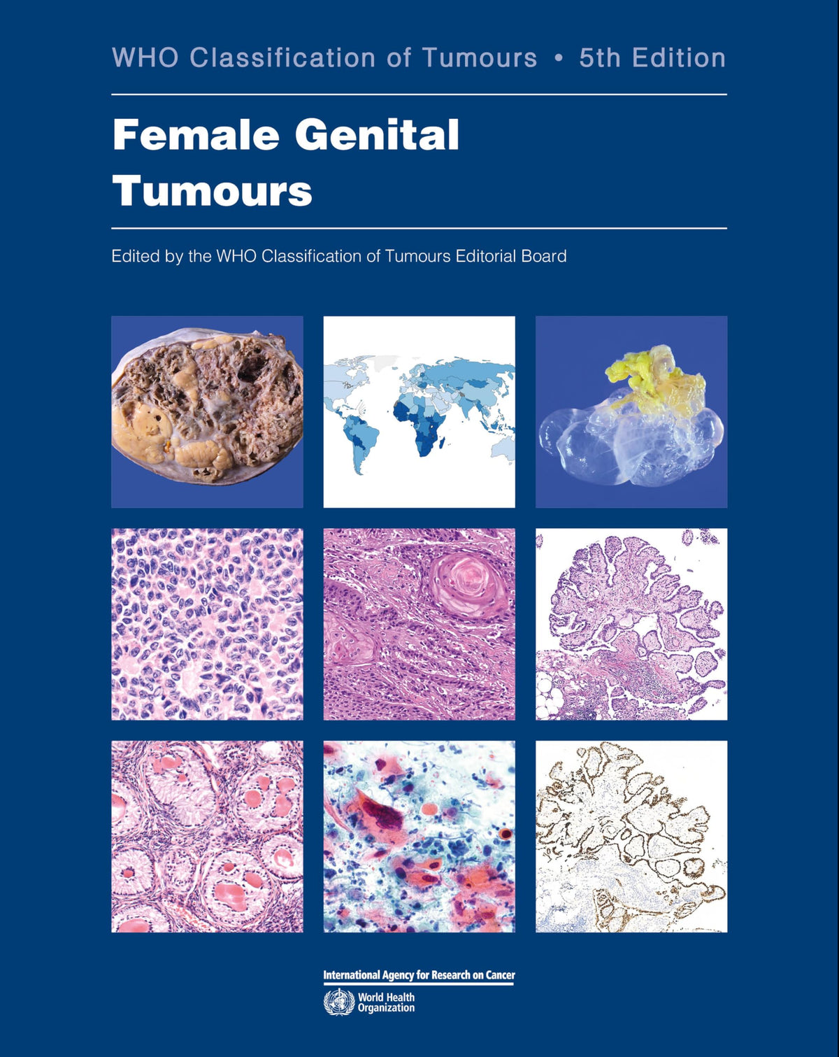 WHO classification of female genital tumours: Who Classification of Tumours: 4 (World Health Organization Classification of Tumours)