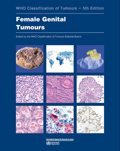 WHO classification of female genital tumours: Who Classification of Tumours: 4 (World Health Organization Classification of Tumours)