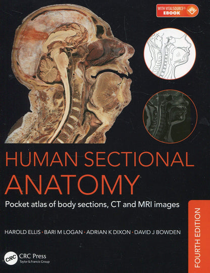 Human Sectional Anatomy: Pocket atlas of body sections, CT and MRI images, Fourth edition