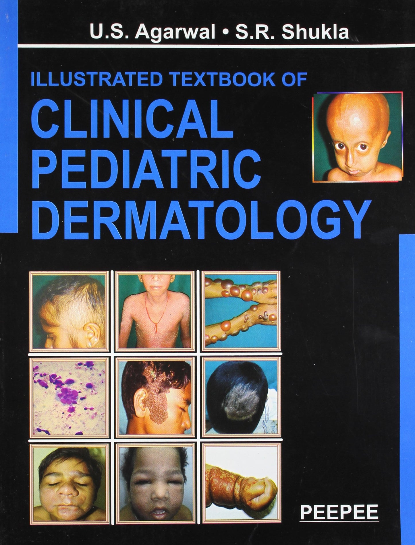 Illustrated Textbook Of Clinical Pediatric Dermatology book cover